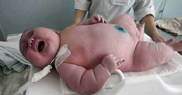 5 Largest Babies Born in the World 