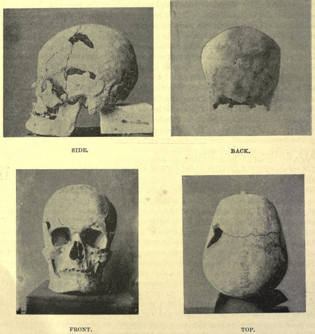 Pharaoh Sanakht’s Skeleton