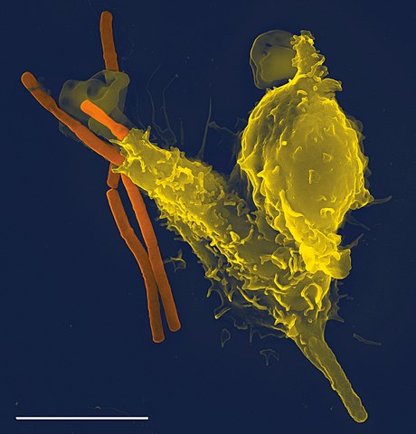 Immunoelectrophoretically